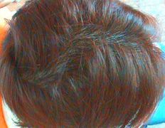 Медицинский центр лечения волос и кожи головы АМД Лаборатории, Примеры работ - фото 13