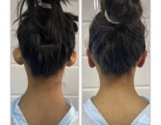 Клиника красоты и здоровья ЮТА, Отопластика - фото 3