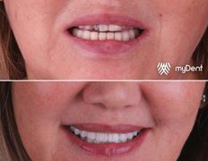 Стоматология My Dent (Май Дент), Примеры работ - фото 6