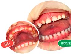 Многопрофильный медицинский центр AQmed (АКмед), Наши работы - фото 5