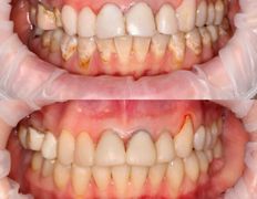 Стоматологический центр Whitestory (Уайтстори), Примеры работ - фото 1