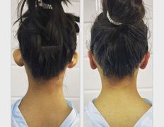 Клиника красоты и здоровья ЮТА, Отопластика - фото 9