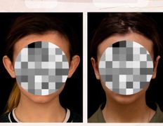 Медицинский центр Ultraline (Ультралайн), До/После - фото 4