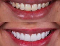 Стоматологическая клиника Любимая, Галерея - фото 19