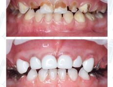 Стоматологический центр Kids Smile (Кидс Смайл), Примеры работ - фото 8