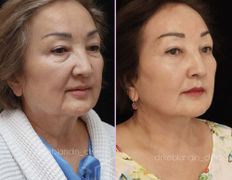 null Клиника пластической хирургии доктора Кобландина, Примеры работ - фото 7