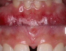 Стоматология One Dent (Уан Дент), Примеры работ - фото 9