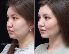 null Клиника пластической хирургии доктора Кобландина, Примеры работ - фото 13