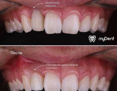 Стоматология My Dent (Май Дент), Примеры работ - фото 7