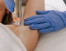 Клиника здоровой кожи SmartDerma (СмартДерма), Аппаратная косметология - фото 2