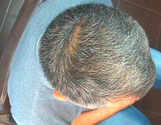 Медицинский центр лечения волос и кожи головы АМД Лаборатории, Примеры работ - фото 6