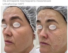 Медицинский центр ANNA Vi CLINICS (Анна Ви Клиникс), Наши работы - фото 3
