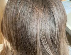 Медицинский центр лечения волос и кожи головы АМД Лаборатории, Примеры работ - фото 10