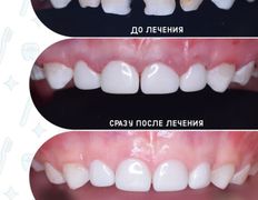 Стоматологический центр Kids Smile (Кидс Смайл), Примеры работ - фото 9