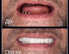 Стоматологическая клиника DentalPark (ДенталПарк), Работы - фото 2