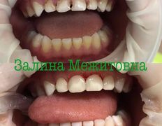 Стоматология AQstom (АКстом), Наши услуги - фото 7