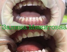 Стоматология AQstom (АКстом), Наши услуги - фото 5