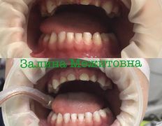 Стоматология AQstom (АКстом), Наши услуги - фото 3