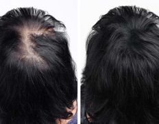 Медицинский центр лечения волос и кожи головы АМД Лаборатории, Примеры работ - фото 4