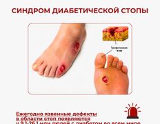Центр подологии и эндокринологии Diafoot.kz (Диафут.кз), Диабетическая обувь - фото 1