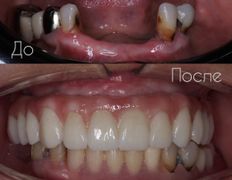 Стоматология One Dent (Уан Дент), Примеры работ - фото 8