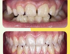 Стоматологический центр Kids Smile (Кидс Смайл), Примеры работ - фото 10