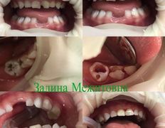 Стоматология AQstom (АКстом), Наши услуги - фото 4