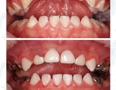 Стоматологический центр Kids Smile (Кидс Смайл), Примеры работ - фото 2