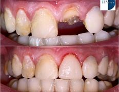 Стоматология AQstom (АКстом), Наши работы - фото 4