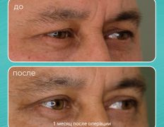 Клиника пластической хирургии Plastika Clinic (Пластика клиник), Примеры работ - фото 11