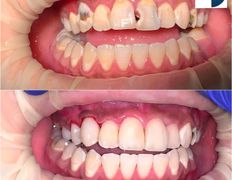 Стоматология AQstom (АКстом), Наши работы - фото 1