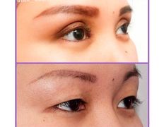 null Клиника пластической хирургии доктора Кобландина, Наши работы - фото 10