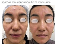 Медицинский центр ANNA Vi CLINICS (Анна Ви Клиникс), Наши работы - фото 18