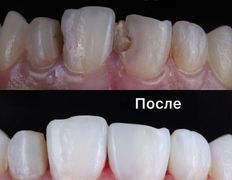 Стоматология One Dent (Уан Дент), Примеры работ - фото 7