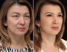 null Клиника пластической хирургии доктора Кобландина, Примеры работ - фото 12