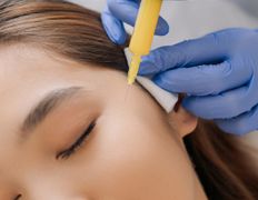 Клиника здоровой кожи SmartDerma (СмартДерма), Инъекционная косметология - фото 9