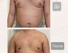 Медицинский центр Ultraline (Ультралайн), До/После - фото 6