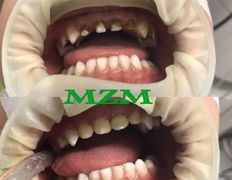 Стоматология AQstom (АКстом), Наши услуги - фото 19