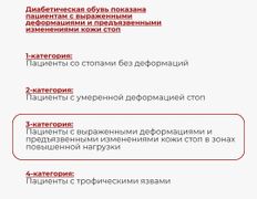 Центр подологии и эндокринологии Diafoot.kz (Диафут.кз), Диабетическая обувь - фото 4