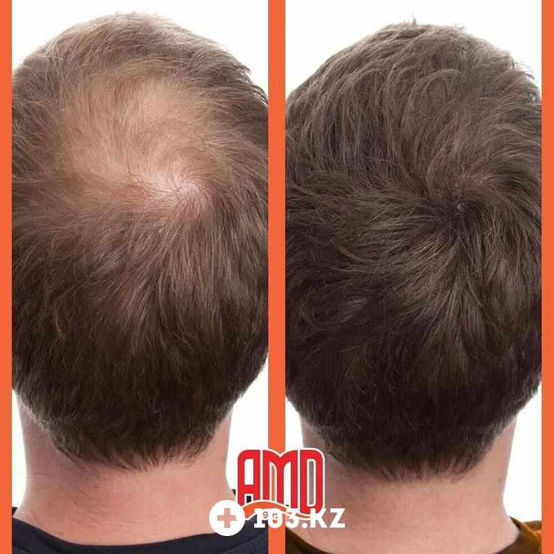 Примеры работ Медицинский центр лечения волос и кожи головы «АМД Лаборатории» - фото 1633356