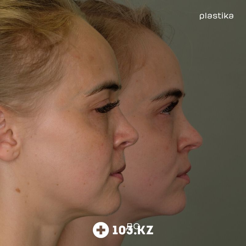 Примеры работ Клиника пластической хирургии «Plastika Clinic (Пластика клиник)» - фото 1652534
