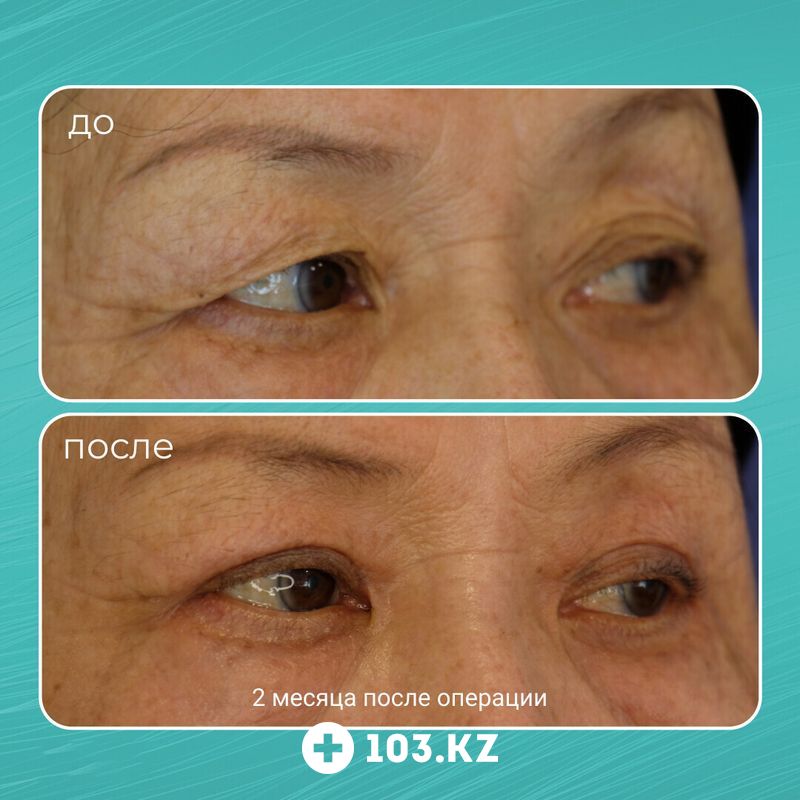 Примеры работ Клиника пластической хирургии «Plastika Clinic (Пластика клиник)» - фото 1652582