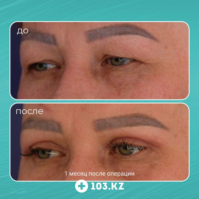 Примеры работ Клиника пластической хирургии «Plastika Clinic (Пластика клиник)» - фото 1652579