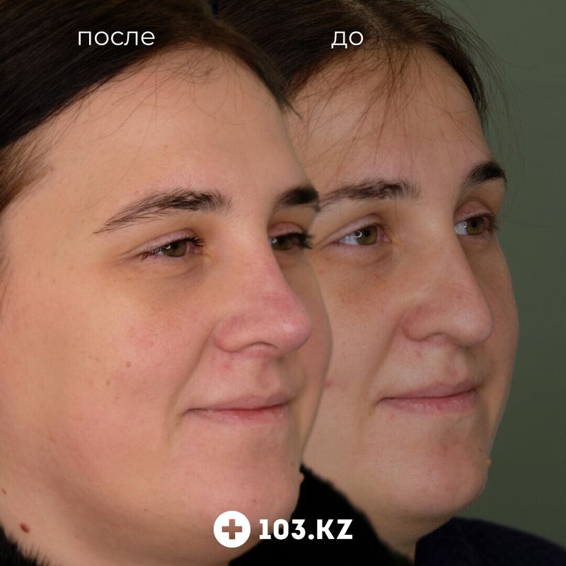 Примеры работ Клиника пластической хирургии «Plastika Clinic (Пластика клиник)» - фото 1652531