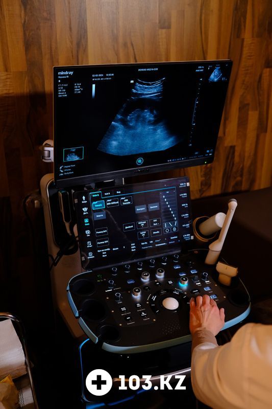 Галерея УЗИ - медицинский центр «Митралия» - фото 1665076