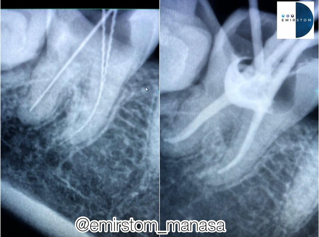 Наши работы Стоматология «AQstom (АКстом)» - фото 1633916